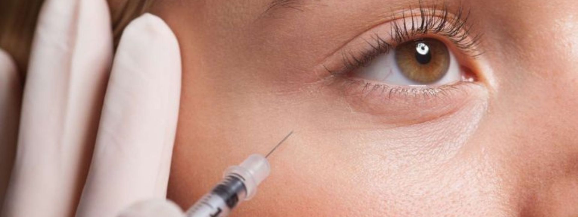 Botulinum Toxin Injections (Unlocking Renewed Confidence)